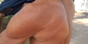 Ai doeu! Homem é agredido com panadas de facão no povoado Bode em Lima Campos