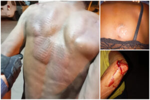 SGT. Eduardo fala sobre a prisão de um homem que agrediu mãe e esposa na zona rural de Lima Campos