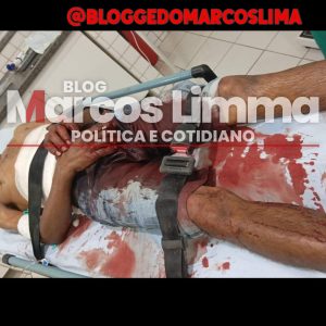 VIOLÊNCIA! Mulher esfaqueia homem na cidade de Lima Campos