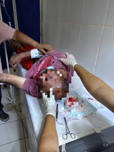 LIMA CAMPOS – “Neném Jackson” vai parar no hospital após ser agredido com uma cadeirada na cabeça