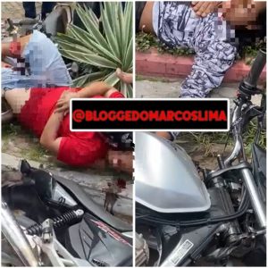 Em Lima Campos um casal bate motocicleta na viatura da PM, e um homem fica com fraturas