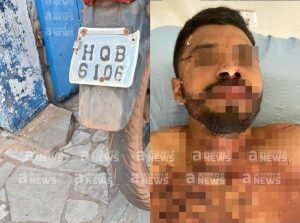 Homem é encontrado sem vida após ser “linchado” na zona rural de São Luís Gonzaga