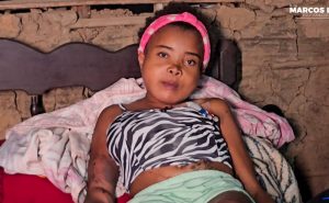 SOLIDARIEDADE – AJUDE A CAMPANHA EM FAVOR DA JOVEM GILVANA, EM LIMA CAMPOS